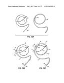 SYSTEMS, DEVICES AND METHODS FOR TREATING THE HEART WITH ABLATION diagram and image