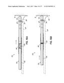 SYSTEMS, DEVICES AND METHODS FOR TREATING THE HEART WITH ABLATION diagram and image