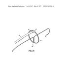 SYSTEMS, DEVICES AND METHODS FOR TREATING THE HEART WITH ABLATION diagram and image