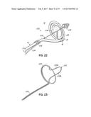 SYSTEMS, DEVICES AND METHODS FOR TREATING THE HEART WITH ABLATION diagram and image