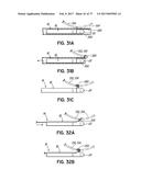 SYSTEMS, DEVICES AND METHODS FOR TREATING THE HEART WITH ABLATION diagram and image