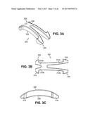 SCLERAL PROSTHESIS FOR TREATING PRESBYOPIA AND OTHER EYE DISORDERS AND     RELATED DEVICES AND METHODS diagram and image