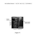 DIGITAL PROTEIN SENSING CHIP AND METHODS FOR DETECTION OF LOW     CONCENTRATIONS OF MOLECULES diagram and image