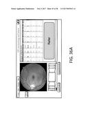 SYSTEMS AND METHODS FOR AUTOMATED DETECTION OF REGIONS OF INTEREST IN     RETINAL IMAGES diagram and image