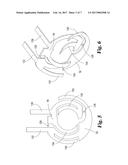 OVER-THE-WIRE ULTRASOUND SYSTEM WITH TORQUE-CABLE DRIVEN ROTARY TRANSDUCER diagram and image