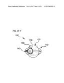 METHODS AND DEVICES FOR SOFT TISSUE DISSECTION diagram and image