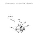 METHODS AND DEVICES FOR SOFT TISSUE DISSECTION diagram and image