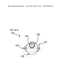 METHODS AND DEVICES FOR SOFT TISSUE DISSECTION diagram and image