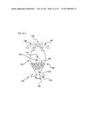 METHODS AND DEVICES FOR SOFT TISSUE DISSECTION diagram and image