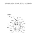 METHODS AND DEVICES FOR SOFT TISSUE DISSECTION diagram and image