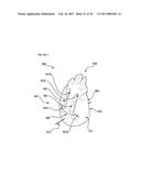 METHODS AND DEVICES FOR SOFT TISSUE DISSECTION diagram and image