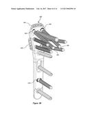 BONE PLATE WITH ELEVATED SUTURE HOLE STRUCTURES diagram and image