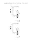 BONE POSITIONING AND PREPARING GUIDE SYSTEMS AND METHODS diagram and image