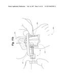 BONE POSITIONING AND PREPARING GUIDE SYSTEMS AND METHODS diagram and image