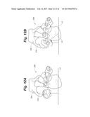 BONE POSITIONING AND PREPARING GUIDE SYSTEMS AND METHODS diagram and image