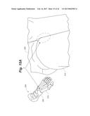 BONE POSITIONING AND PREPARING GUIDE SYSTEMS AND METHODS diagram and image