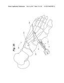 BONE POSITIONING AND PREPARING GUIDE SYSTEMS AND METHODS diagram and image