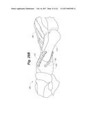 BONE POSITIONING AND PREPARING GUIDE SYSTEMS AND METHODS diagram and image