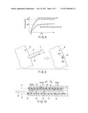 GRASPING TREATMENT UNIT, GRASPING TREATMENT INSTRUMENT AND GRASPING     TREATMENT SYSTEM diagram and image