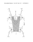 TISSUE ANCHOR AND A SUTURE INSERTED THROUGH THE TISSUE ANCHOR HAVING END     PORTIONS OF THE SUTURE MAINTAINED WITHIN A CONDUIT diagram and image