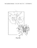 TISSUE ANCHOR AND A SUTURE INSERTED THROUGH THE TISSUE ANCHOR HAVING END     PORTIONS OF THE SUTURE MAINTAINED WITHIN A CONDUIT diagram and image