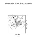 TISSUE ANCHOR AND A SUTURE INSERTED THROUGH THE TISSUE ANCHOR HAVING END     PORTIONS OF THE SUTURE MAINTAINED WITHIN A CONDUIT diagram and image