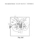 TISSUE ANCHOR AND A SUTURE INSERTED THROUGH THE TISSUE ANCHOR HAVING END     PORTIONS OF THE SUTURE MAINTAINED WITHIN A CONDUIT diagram and image