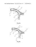 Medical Device diagram and image