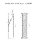 STENT HAVING REMOVABLE ANCHORING ELEMENT diagram and image