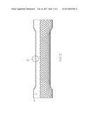 STENT HAVING REMOVABLE ANCHORING ELEMENT diagram and image