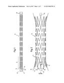 Implant with Attached Element and Method of Making Such an Implant diagram and image