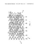 INTRAVASCULAR STENT diagram and image