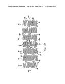 INTRAVASCULAR STENT diagram and image