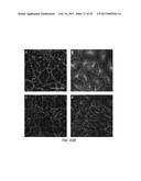 TREATING OCULAR NEOVASCULARIZATION diagram and image