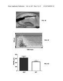 Methods of Treating Neurological Diseases diagram and image