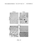 Pancreatic Islets of Transgenic LEA29Y Animals for Treating  Diabetes diagram and image