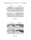 Pancreatic Islets of Transgenic LEA29Y Animals for Treating  Diabetes diagram and image