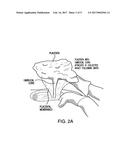 TREATMENT OF CONDITIONS AND COMPLICATIONS IN INFANTS diagram and image