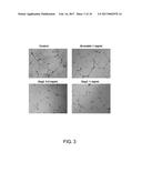 USE OF PEPTIDE FOR TREATING ANGIOGENESIS-RELATED DISEASES diagram and image