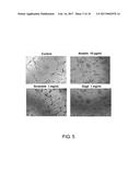 USE OF PEPTIDE FOR TREATING ANGIOGENESIS-RELATED DISEASES diagram and image