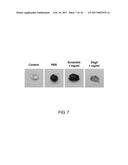 USE OF PEPTIDE FOR TREATING ANGIOGENESIS-RELATED DISEASES diagram and image