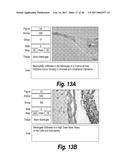 METHODS AND COMPOSITIONS FOR CNS DELIVERY OF HEPARAN N-SULFATASE diagram and image