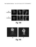 CNS DELIVERY OF THERAPEUTIC AGENTS diagram and image