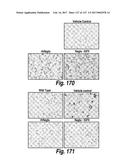 CNS DELIVERY OF THERAPEUTIC AGENTS diagram and image