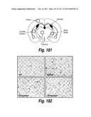 CNS DELIVERY OF THERAPEUTIC AGENTS diagram and image