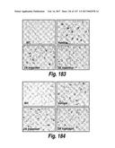 CNS DELIVERY OF THERAPEUTIC AGENTS diagram and image