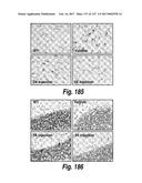 CNS DELIVERY OF THERAPEUTIC AGENTS diagram and image