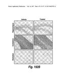 CNS DELIVERY OF THERAPEUTIC AGENTS diagram and image