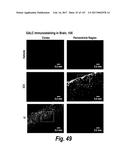 CNS DELIVERY OF THERAPEUTIC AGENTS diagram and image