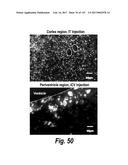 CNS DELIVERY OF THERAPEUTIC AGENTS diagram and image